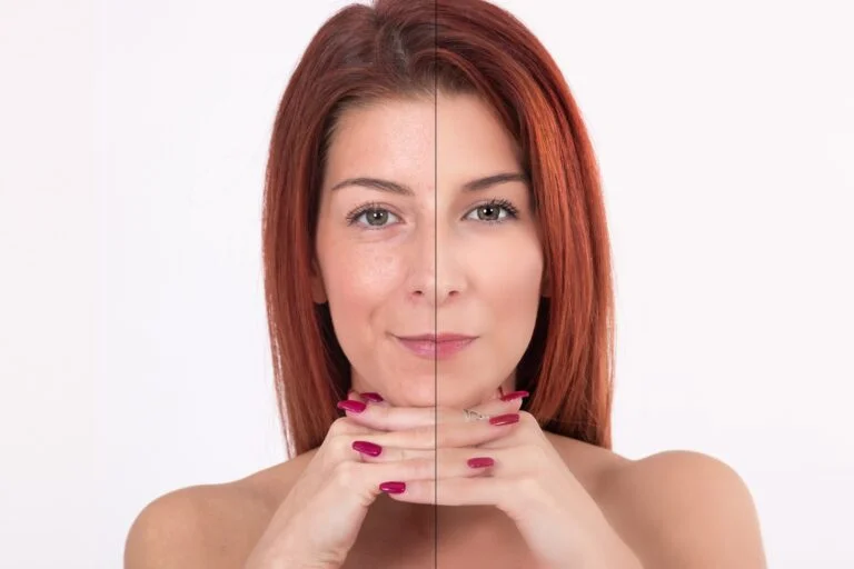 Skin Brightening & Rejuvenation